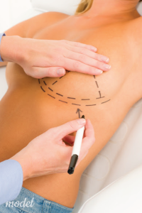 Breast Augmentation in Cleveland, OH